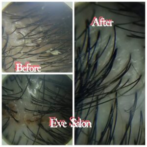 salon ketombe di cipayung depok