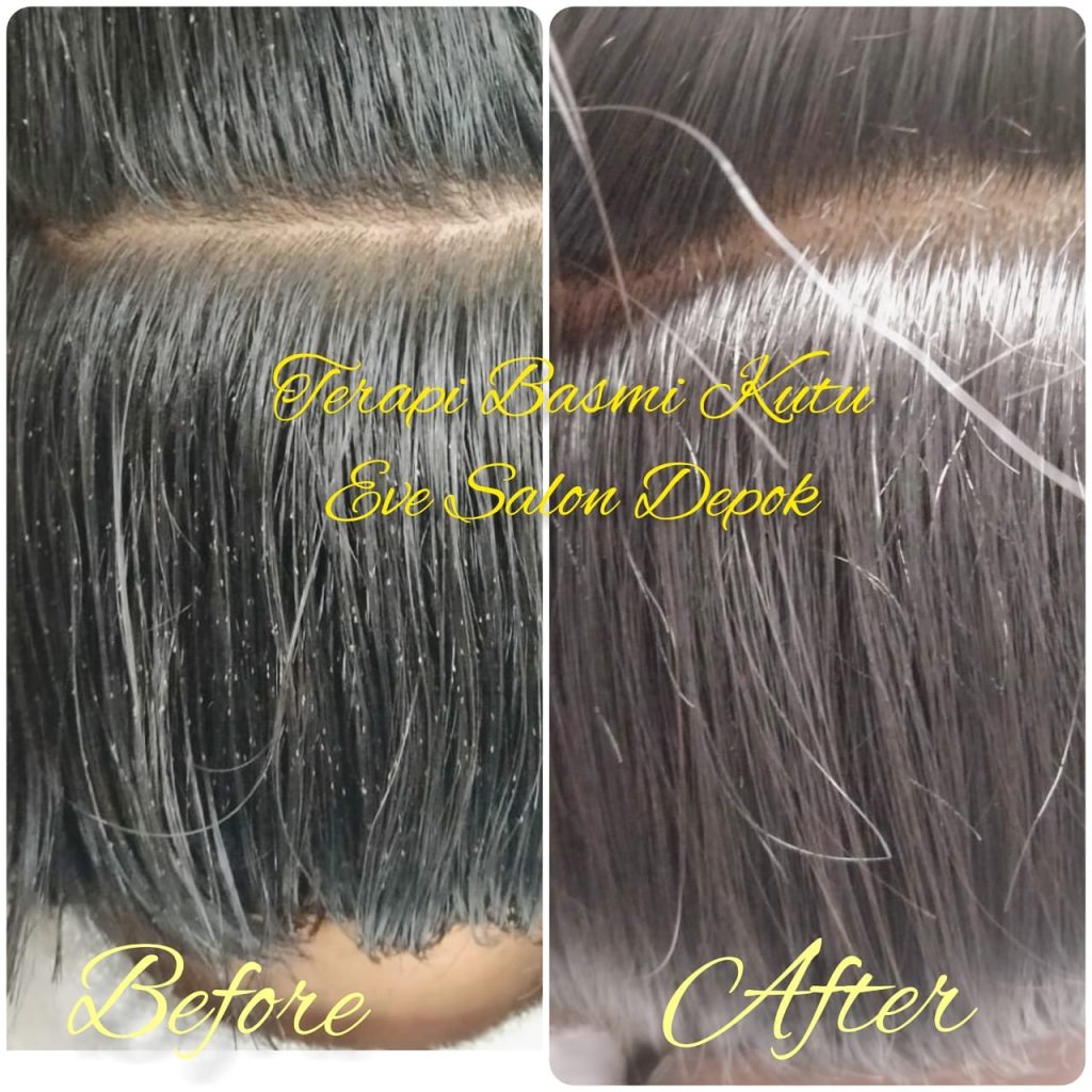 salon pembasmi kutu di jakarta