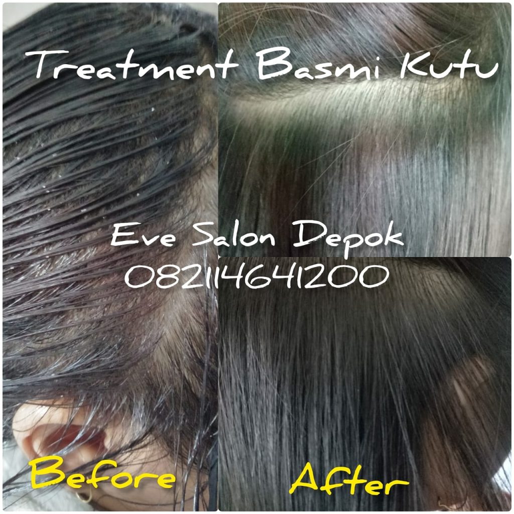 harga salon kutu di cijantung