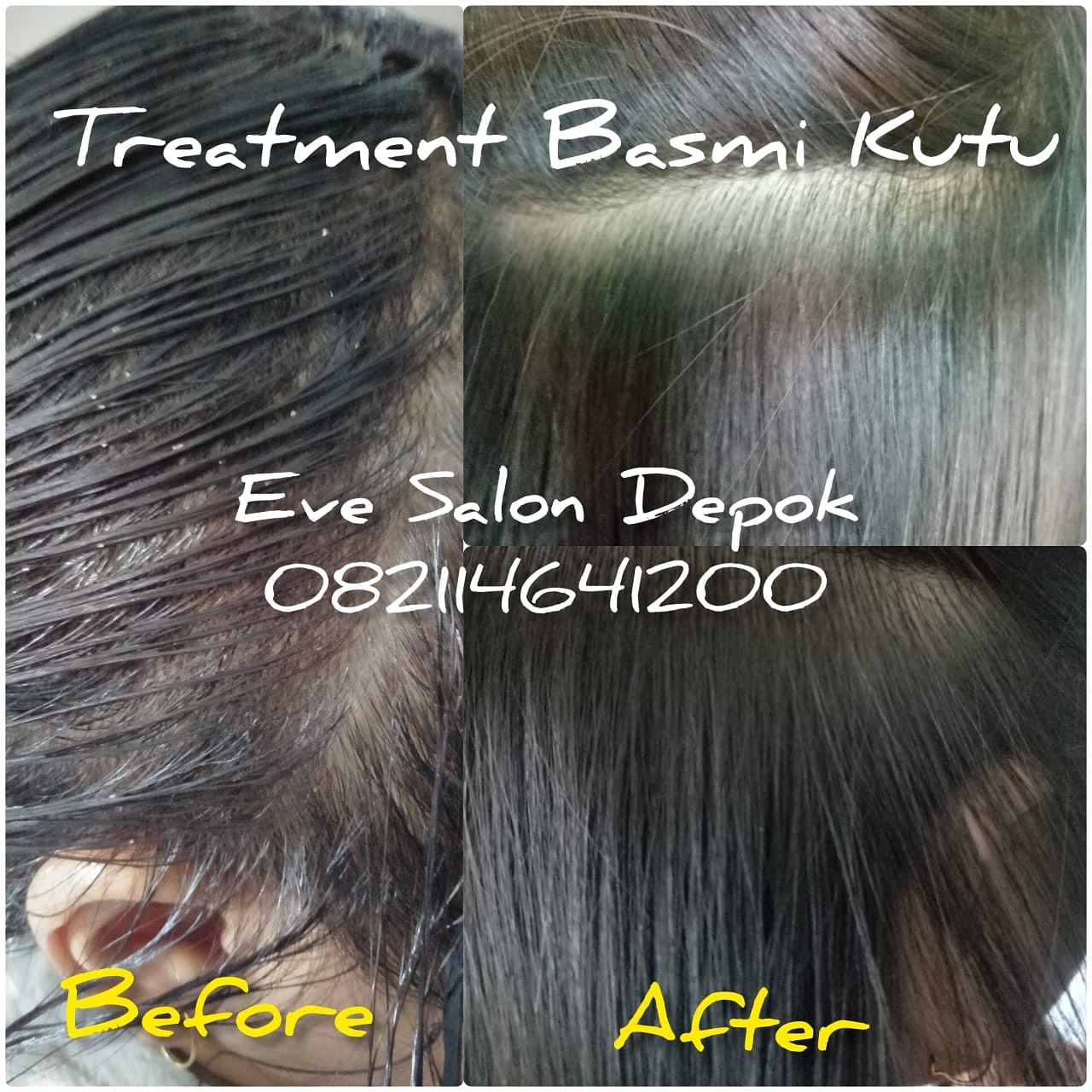 harga salon kutu di cijantung