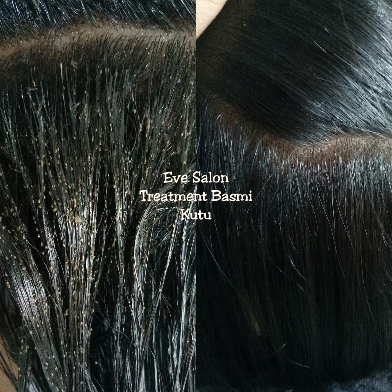 Salon menghilangkan kutu rambut di Pancoran