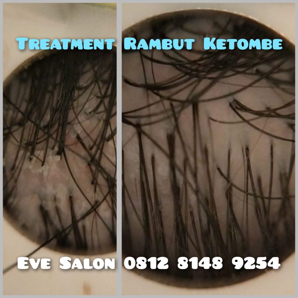 salon ketombe di sawangan