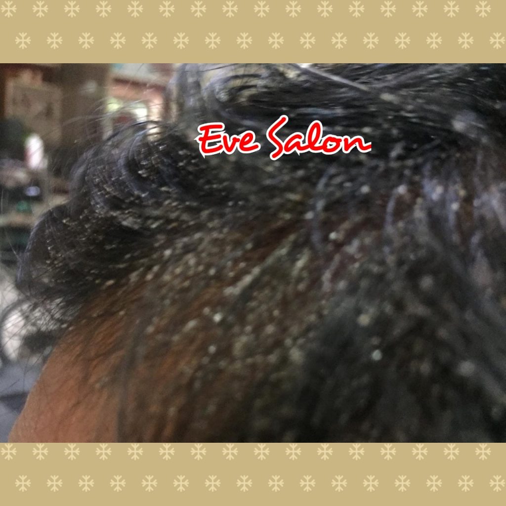 salon kutu rambut di jakarta timur