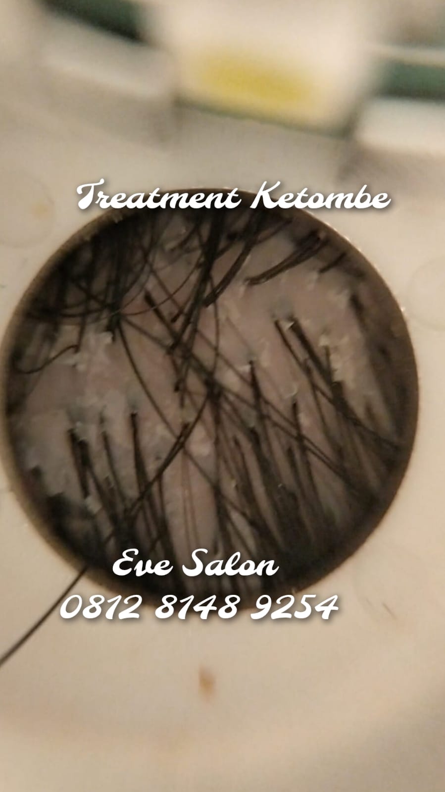 Harga Perawatan Ketombe Di Salon Kampung Sawah Harga Perawatan Ketombe Di Salon Kampung Sawah
