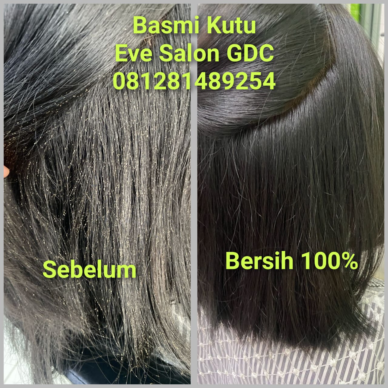 salon kutu Pancoran, menghilangkan kutu rambut, treatment kutu rambut anak, salon kutu Jakarta Selatan, basmi kutu Eve Salon

