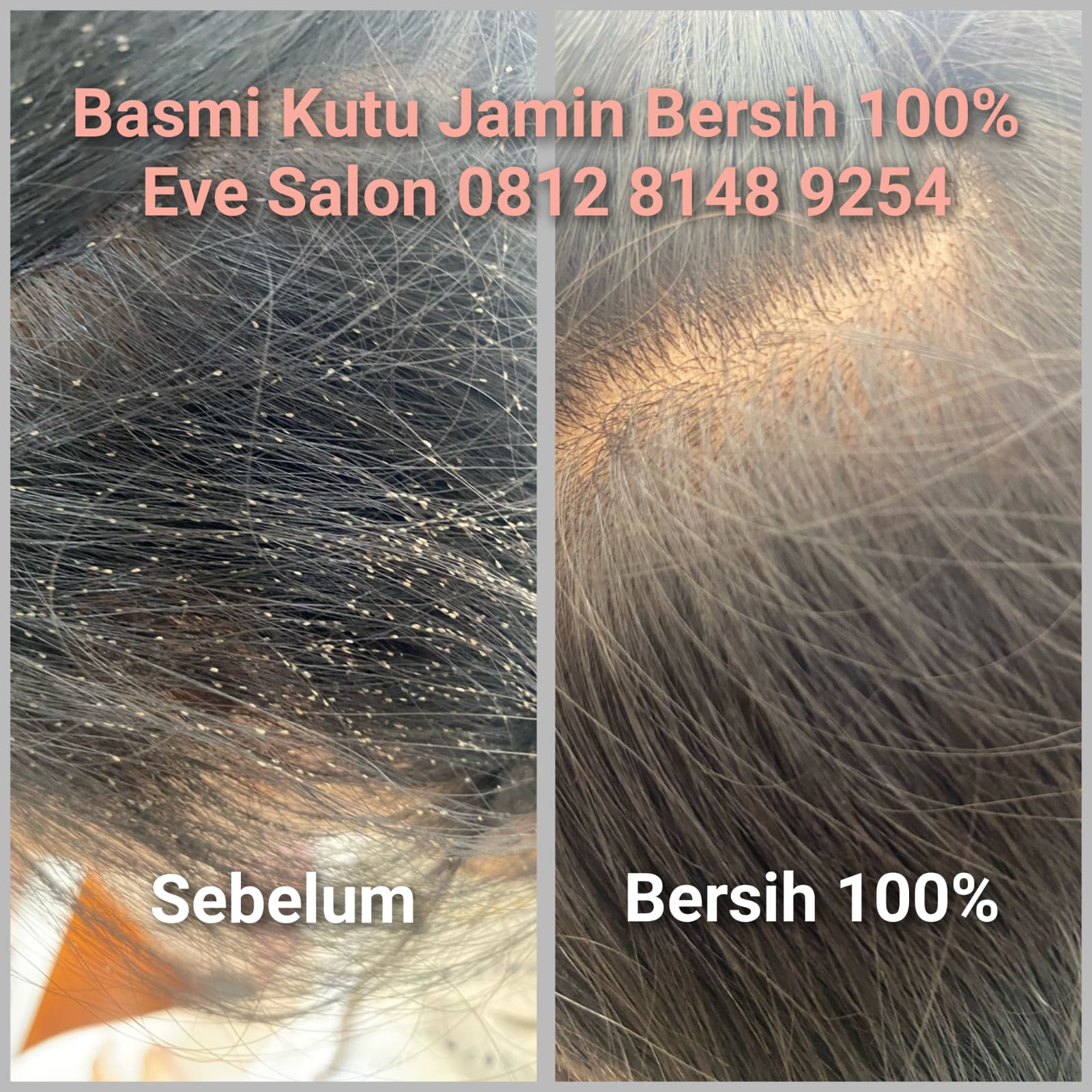 Salon menghilangkan kutu rambut di Cilebut