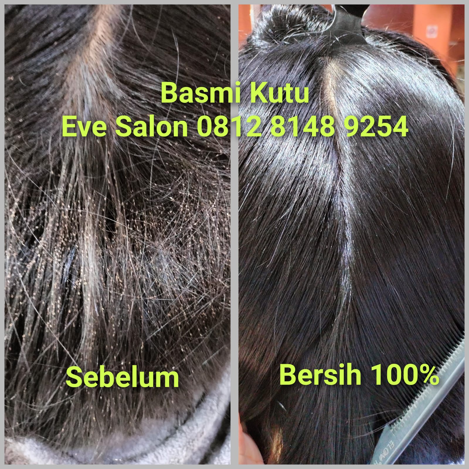 Salon menghilangkan kutu rambut di Tebet