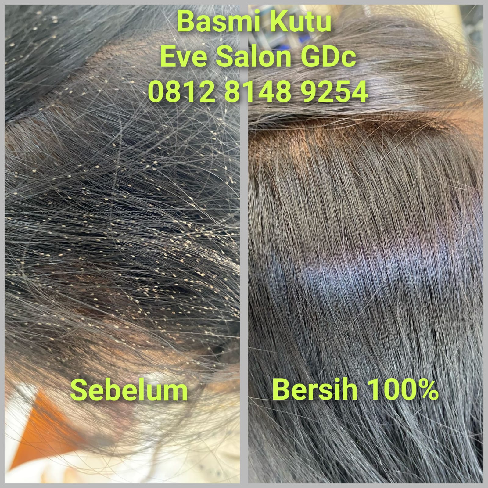 salon kutu bekasi terbaik